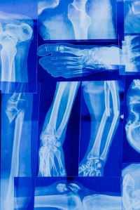 Artificial Intelligence in Radiology: Safeguarding Patients’ Rights in the Digital&nbsp;Era